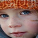 Close-Up of a Child with Freckles and Blue Eyes in a Cozy Knit Hat